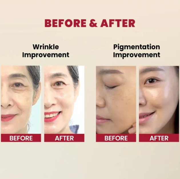 KSECRET - SEOUL 1988 Serum Retinal Liposome 2% + Black Ginseng at Skin Junction Australia