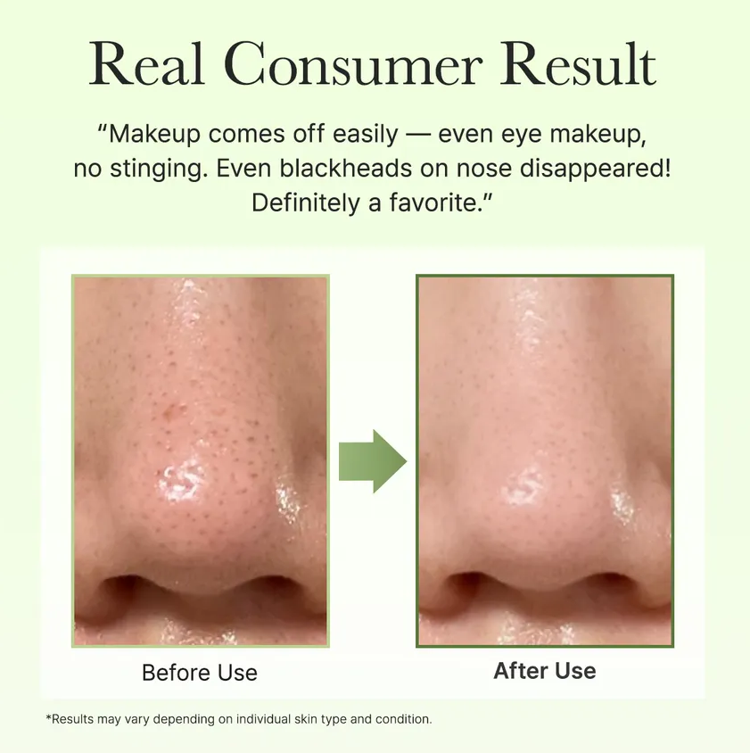 Arencia - Pore Melt Phyto PDRN Cleansing Balm at Skin Junction Australia