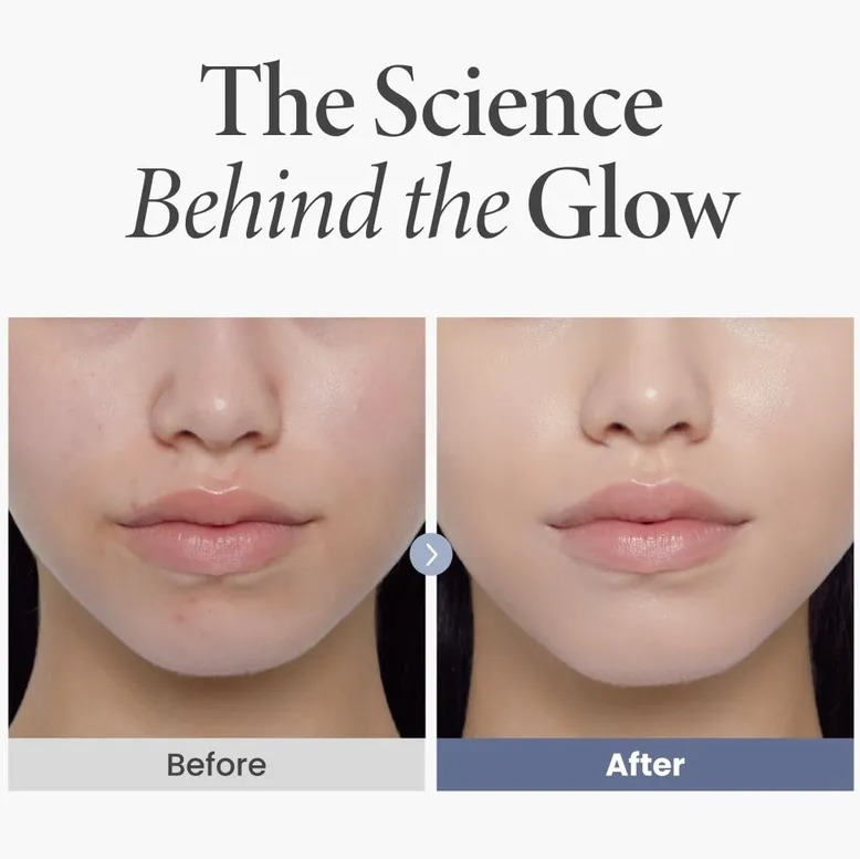 Axis-Y – TXA 2.5% Intensive Brightening Cream at Skin Junction Australia