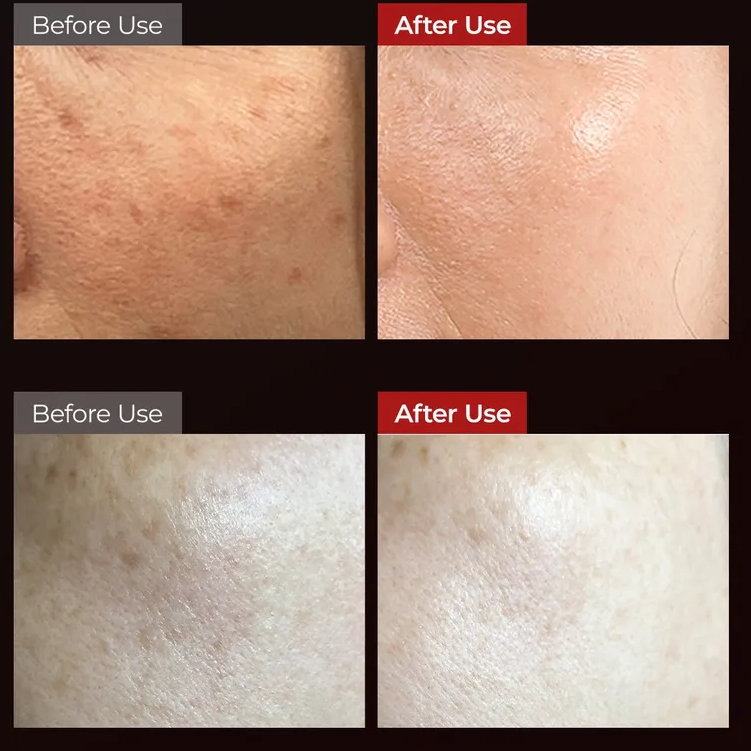 Dr. Melaxin - Astaxanthin Anti-Freckles Whitening Capsule Sun Cream at Skin Junction Australia