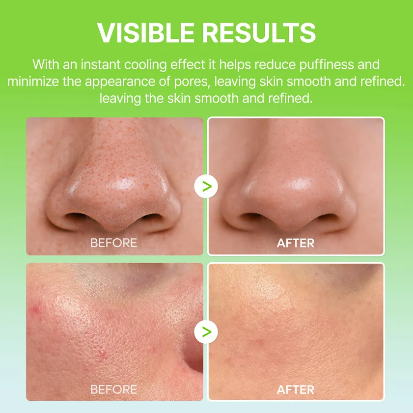 Dr. Melaxin – Cactox Pore Relief Multi Balm at Skin Junction Australia