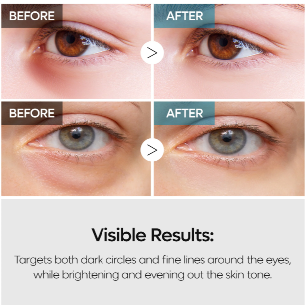Dr Melaxin - TX-Retinalsome Double Effect Eye Cream at Skin Junction Australia