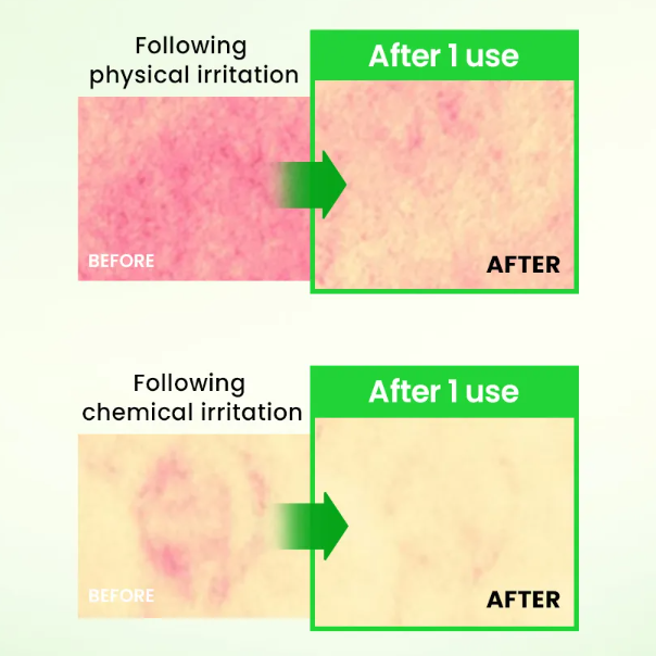 Ilso - Heartleaf Tendersome Double Calming Ampoule at Skin Junction Australia