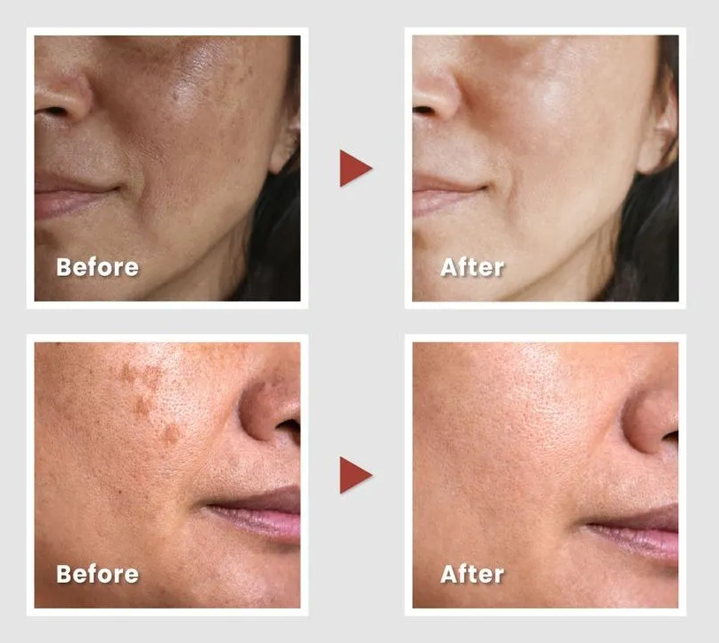 KSECRET - Collagen Vita Secret Multi Balm at Skin Junction Australia