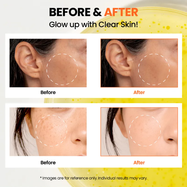 KSECRET - SEOUL 1988 Glow Serum: Niacinamide 15% + Yuja [30ml] at Skin Junction Australia
