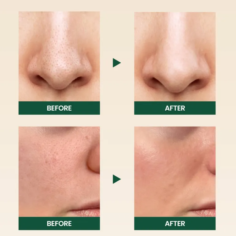 KSECRET - SEOUL 1988 Cleansing Foam : Pine Cica 1% + Probiotics at Skin Junction Australia