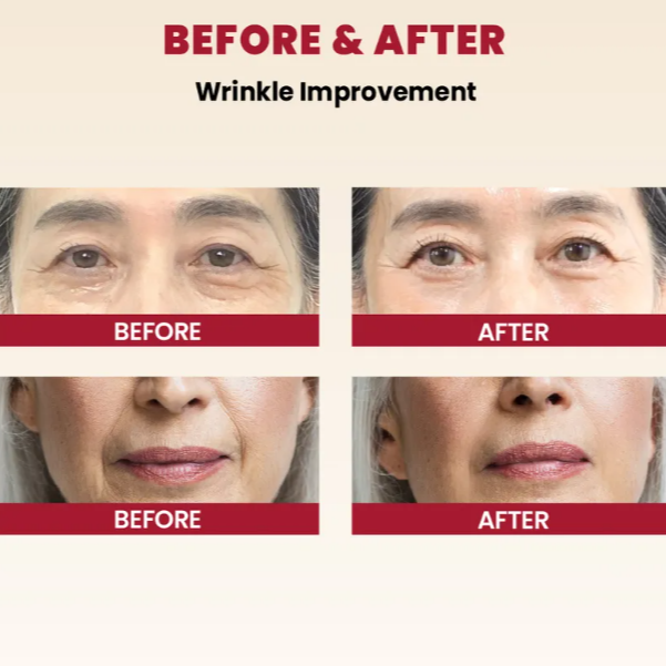 KSECRET - SEOUL 1988 Cream: Retinal Liposome 1% + Fermented Rice 50ml at Skin Junction Australia