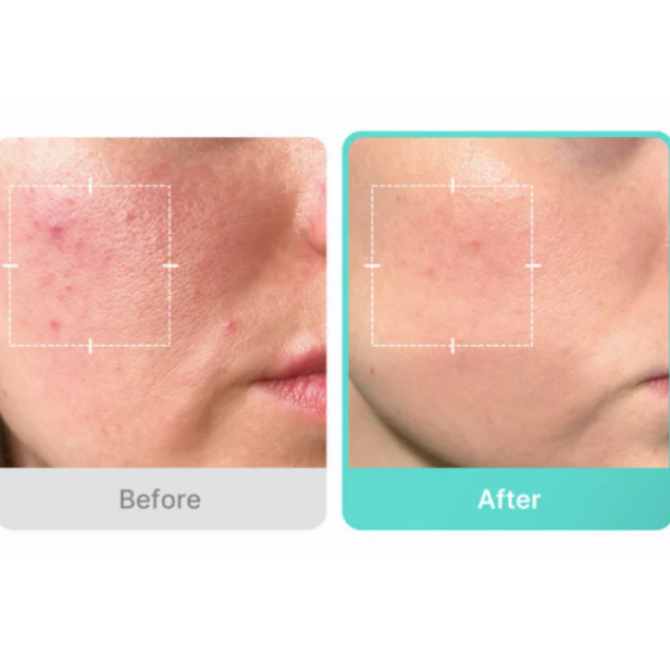 Medicube – Azelaic Acid 16 BB Calming Serum 30ml at Skin Junction Australia