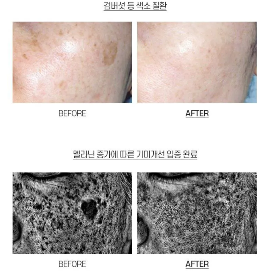 Medipeel - Melanon X Cream at Skin Junction Australia