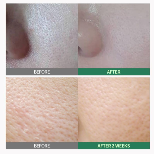 Sungboon Editor - Green Tomato Pore Peeling Jumbo Pad at Skin Junction Australia