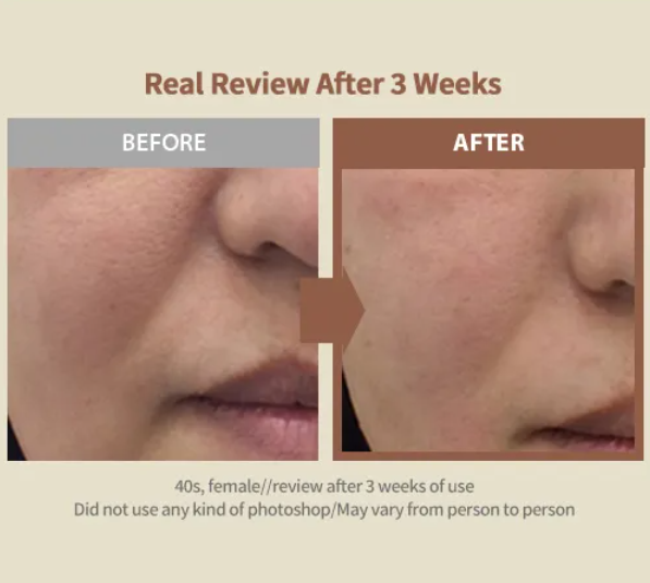 Sungboon Editor - Silk Peptide Intensive Lifting Ampoule 35ml at Skin Junction Australia