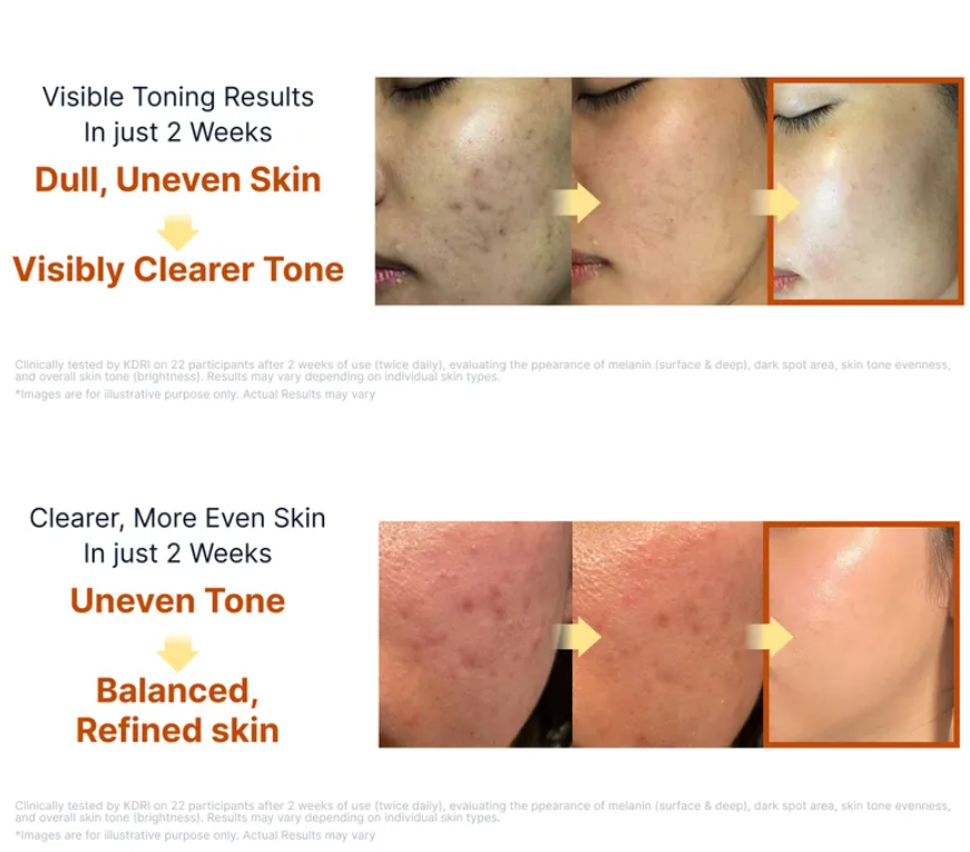 Sungboon Editor - Kojic Acid Niacinamide Brightening Ampoule at Skin Junction Australia